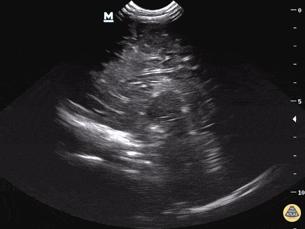 Pediatrics - Head Imaging - Sagittal View
