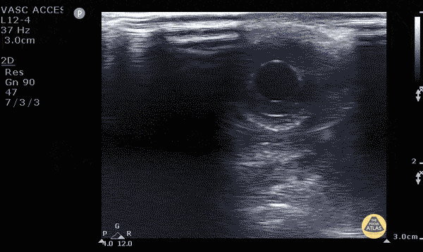 Orbital - Consensual Light Reflex