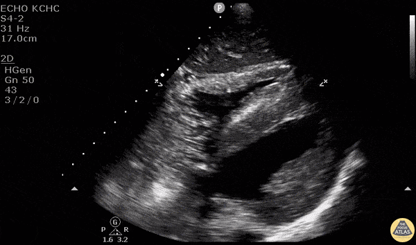 Procedures - Central Line Placement Confirmation