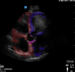 Colorized Atlas - Apical 4 - Colorized Simple