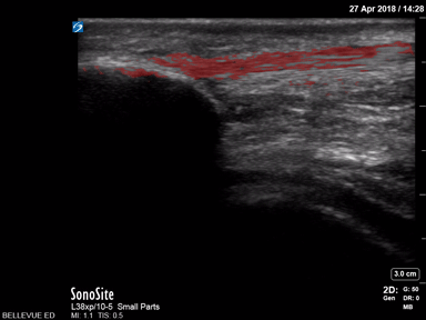 Musculoskeletal - Patellar Tendon - Colorized