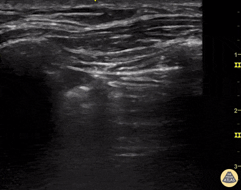 Pulmonary - Lung Point