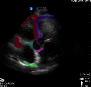 Colorized Atlas - Apical 4 - Colorized - Complex