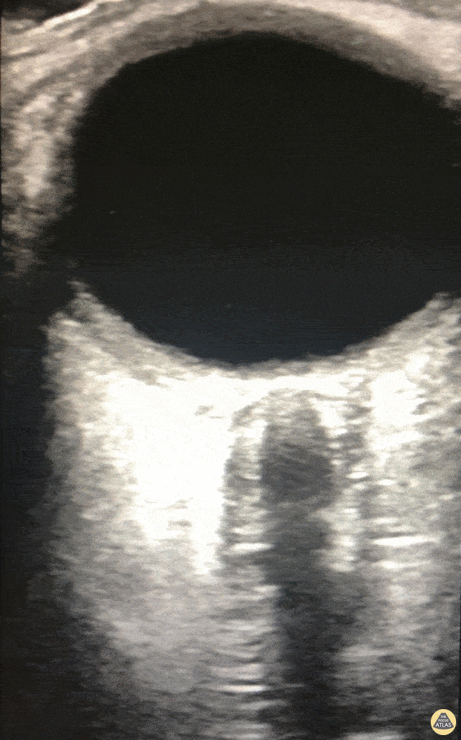 Orbital - ONSD Double Take