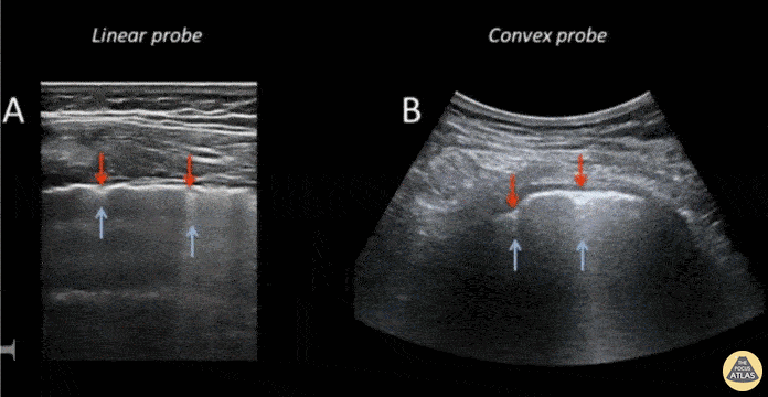 Pulmonary - Lung Windows
