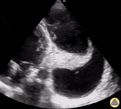 Pulmonary - Unexpected Jellyfish