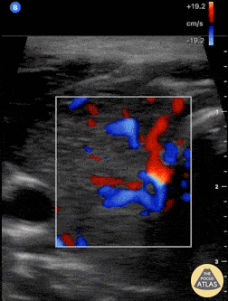 Soft Tissue - Thyroid Inferno