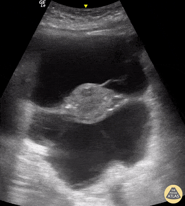 OB/Gyn - TIE Fighter Sign