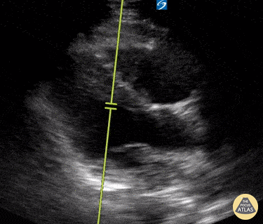 EA Echo Examples - McConnell's Sign