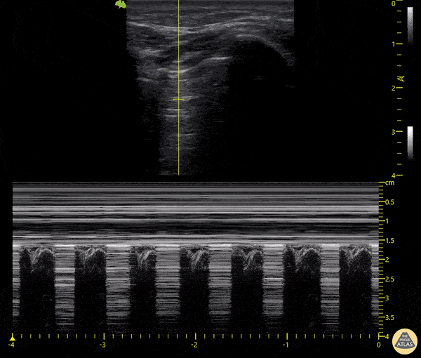 Pulmonary - Lung Point