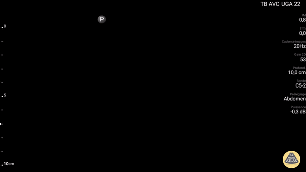 UPLOADS FOR REVIEW - 413