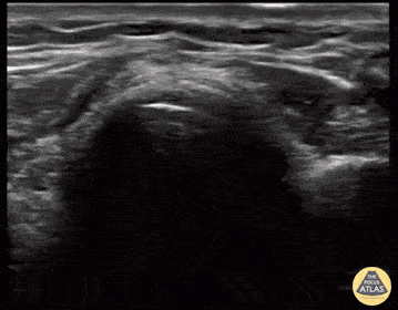 UPLOADS FOR REVIEW - 445