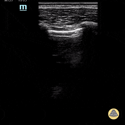 Peds-Lung - Lung Point