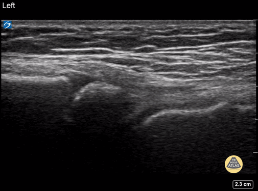 Peds-MSK - Normal Ankle