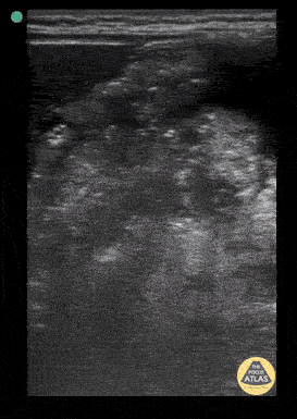 Peds-Gastrointestinal - Full stomach 1