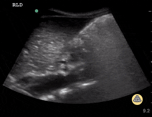 Peds-Gastrointestinal - Full stomach 2