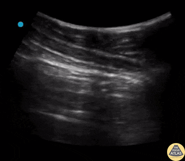 Pulmonary - Lung Point Finding