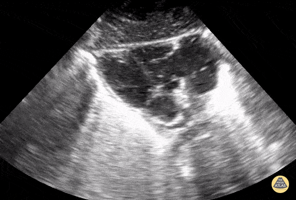 Peds-Cardiac - Cardiac Arrest