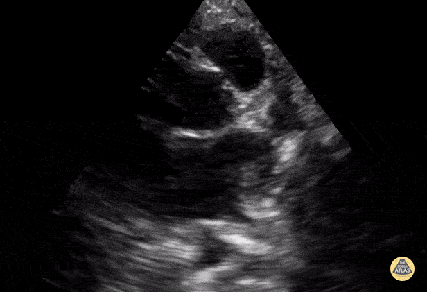 Peds-Cardiac - Older Kid PSSA base